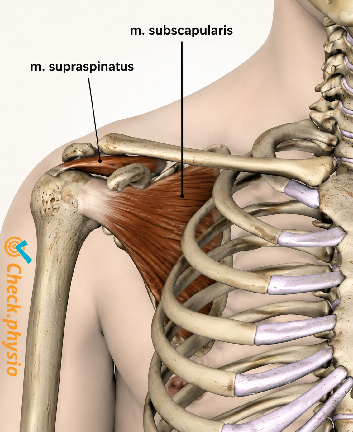 Subscapularis Tendinitis Overview